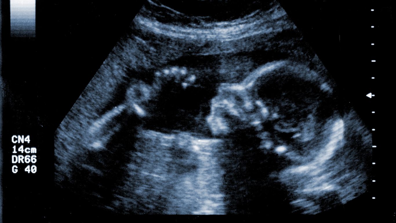 How Ultrasounds Save Lives: The Science Behind the First Look at Life